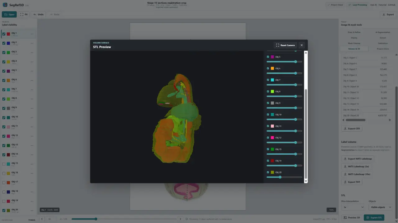 SegRef3D Lite 3D STL preview