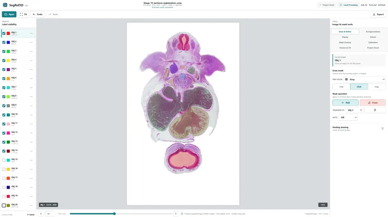SegRef3D Lite segmentation and mask refinement interface